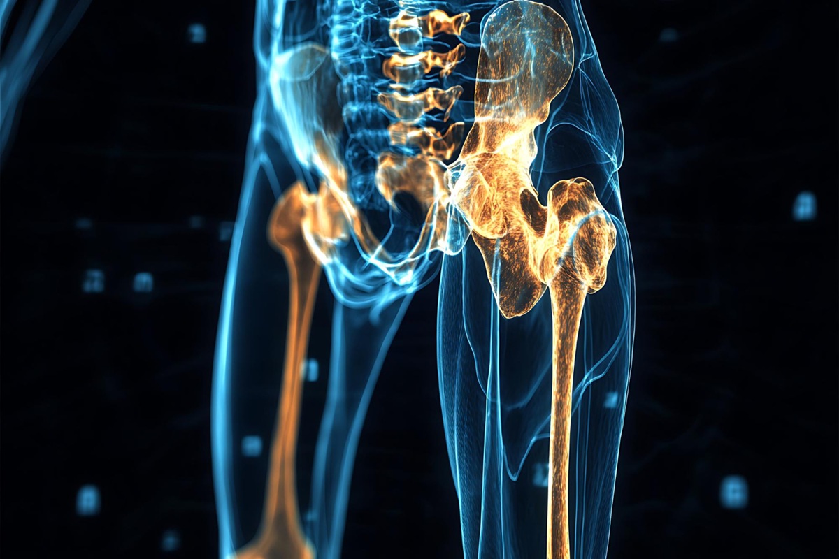 Diagnosing a Hip Labral Tear